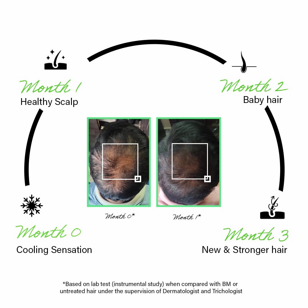 Rootcos Rosemary Hair Growth Serum | Grocsy