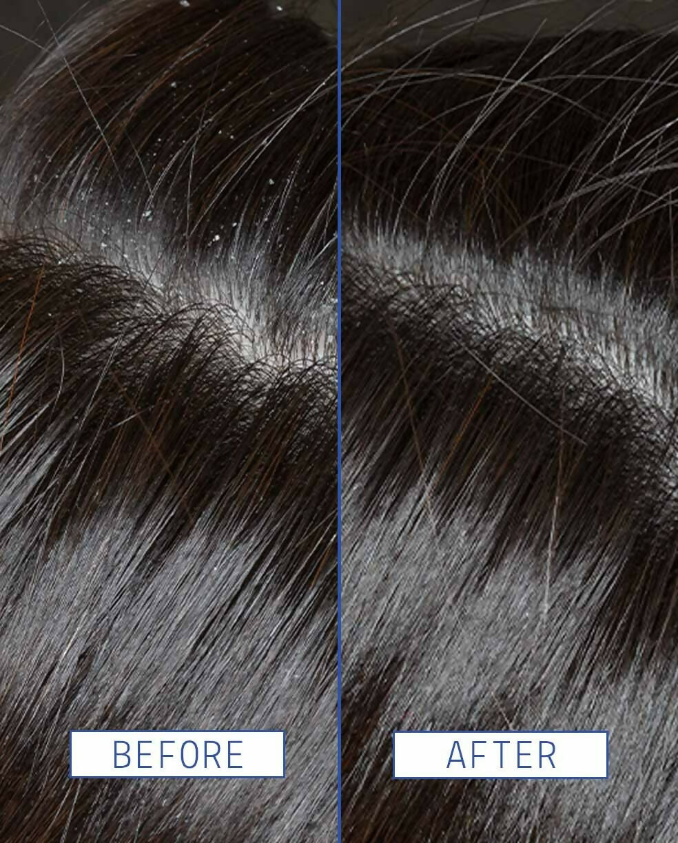 Aavrani Scalp Rescue Serum | Grocsy