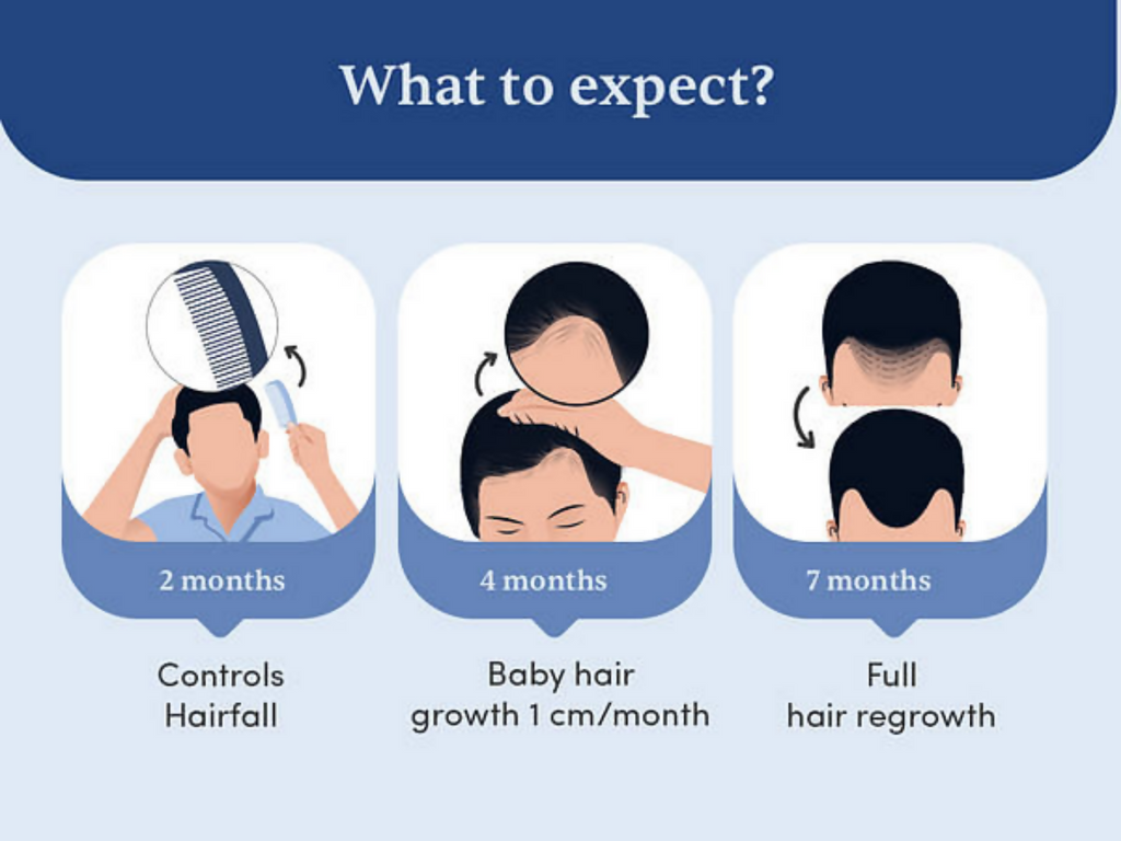 Man Matters Minoxidil 5% Roll On With Procapil | Grocsy