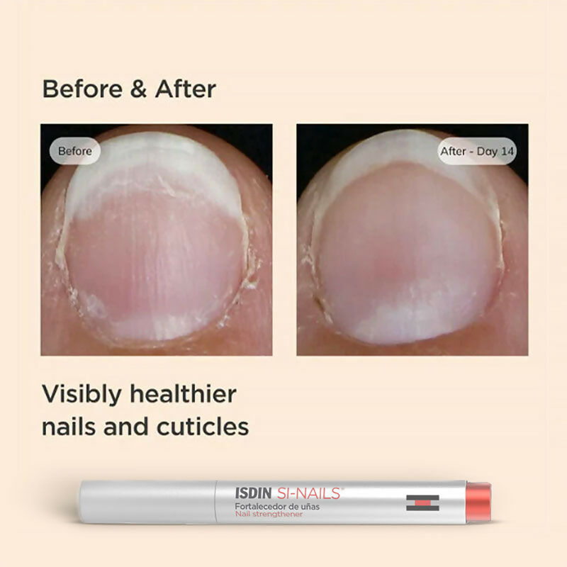 ISDIN Si-Nails Strengthener | Grocsy