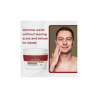 Sabates Pimple Acne Cream For Acne-Prone, Rough & Bumpy Skin | Grocsy