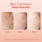 The Pink Foundry Dark Spot & Hyperpigmentation Face Serum | Grocsy