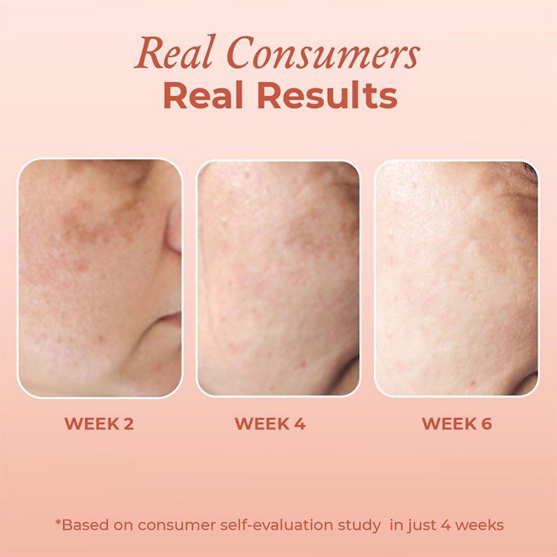 The Pink Foundry Dark Spot & Hyperpigmentation Face Serum | Grocsy