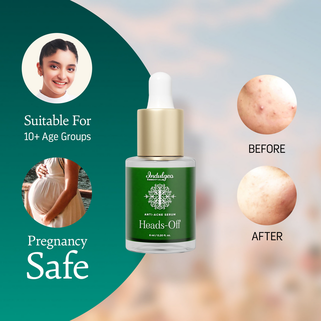 Indulgeo Essentials Heads Off Anti Acne Face Serum | Grocsy