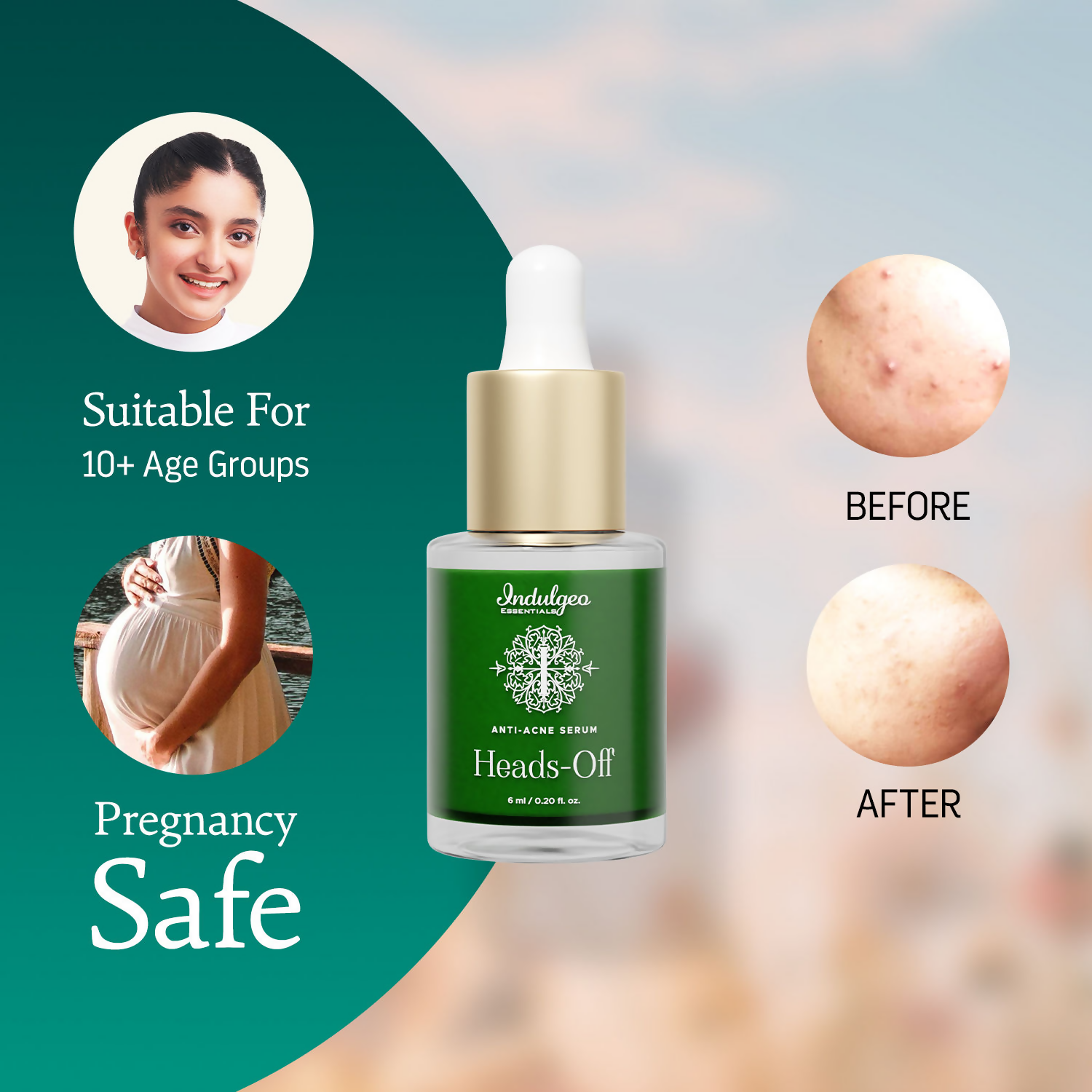 Indulgeo Essentials Heads Off Anti Acne Face Serum | Grocsy
