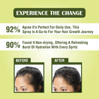 Myherb Rosemary Water Hair Spray For Regrowth, Helps Reduce Hairfall, Strengthens Hair | Grocsy