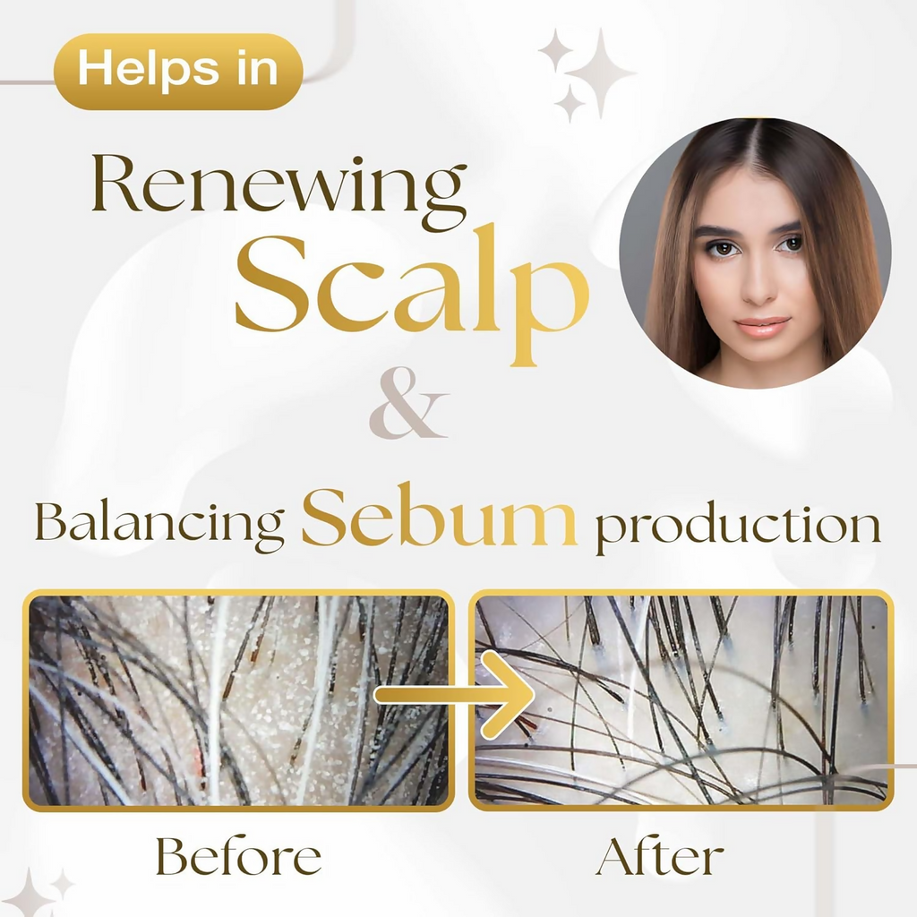 Siya Ayurveda Scalp Exfoliating Serum | Grocsy