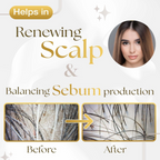 Siya Ayurveda Scalp Exfoliating Serum | Grocsy