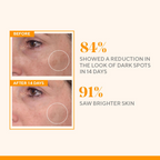 Murad Rapid Dark Spot Correcting Serum | Grocsy