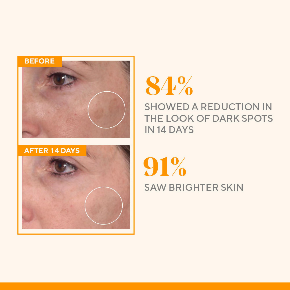 Murad Rapid Dark Spot Correcting Serum | Grocsy
