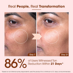 TAC - The Ayurveda Co. Kumkumadi Hydrating Sunscreen SPF 60+ PA++++ | Grocsy