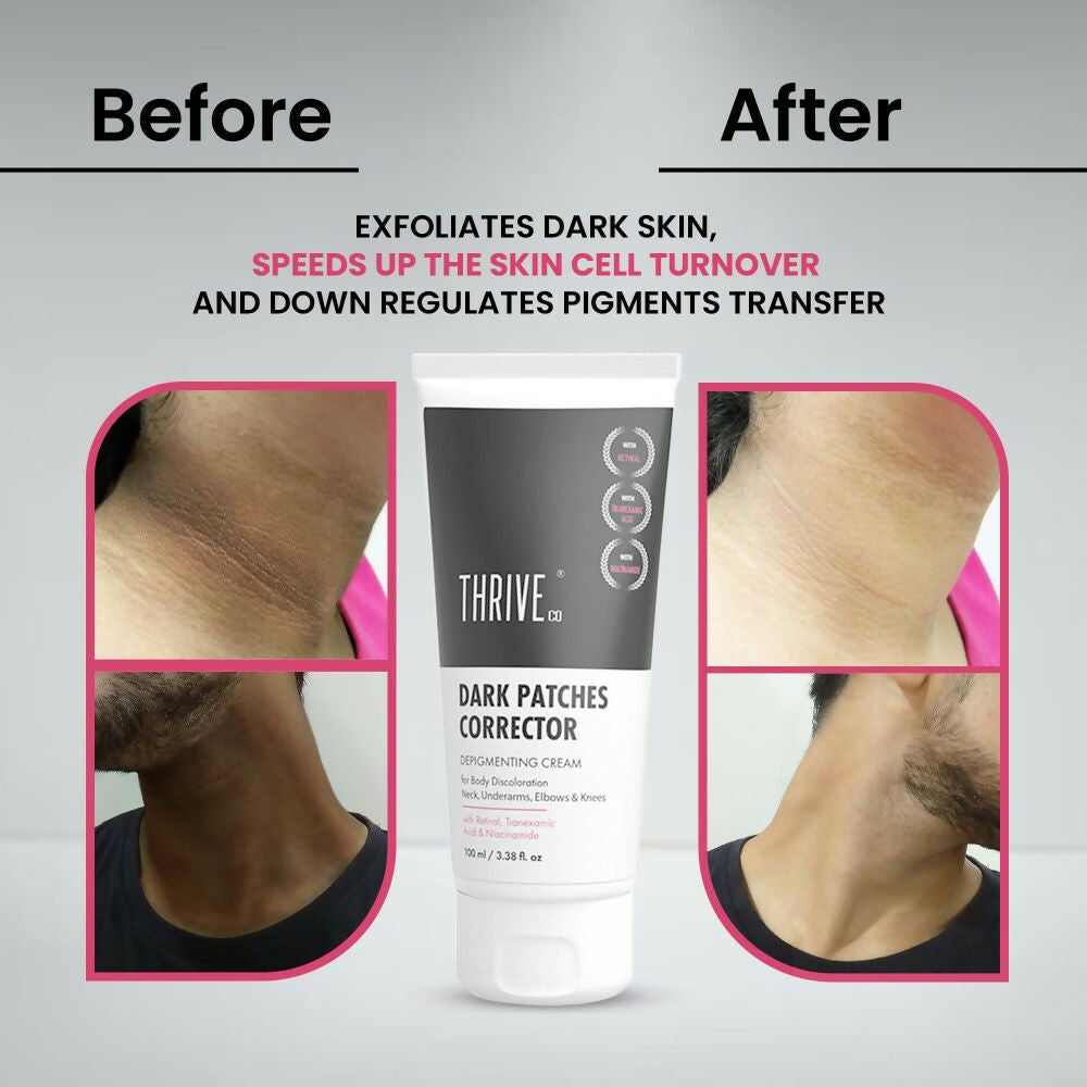Thriveco Dark Patches Corrector Cream | Grocsy