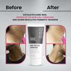 Thriveco Dark Patches Corrector Cream | Grocsy