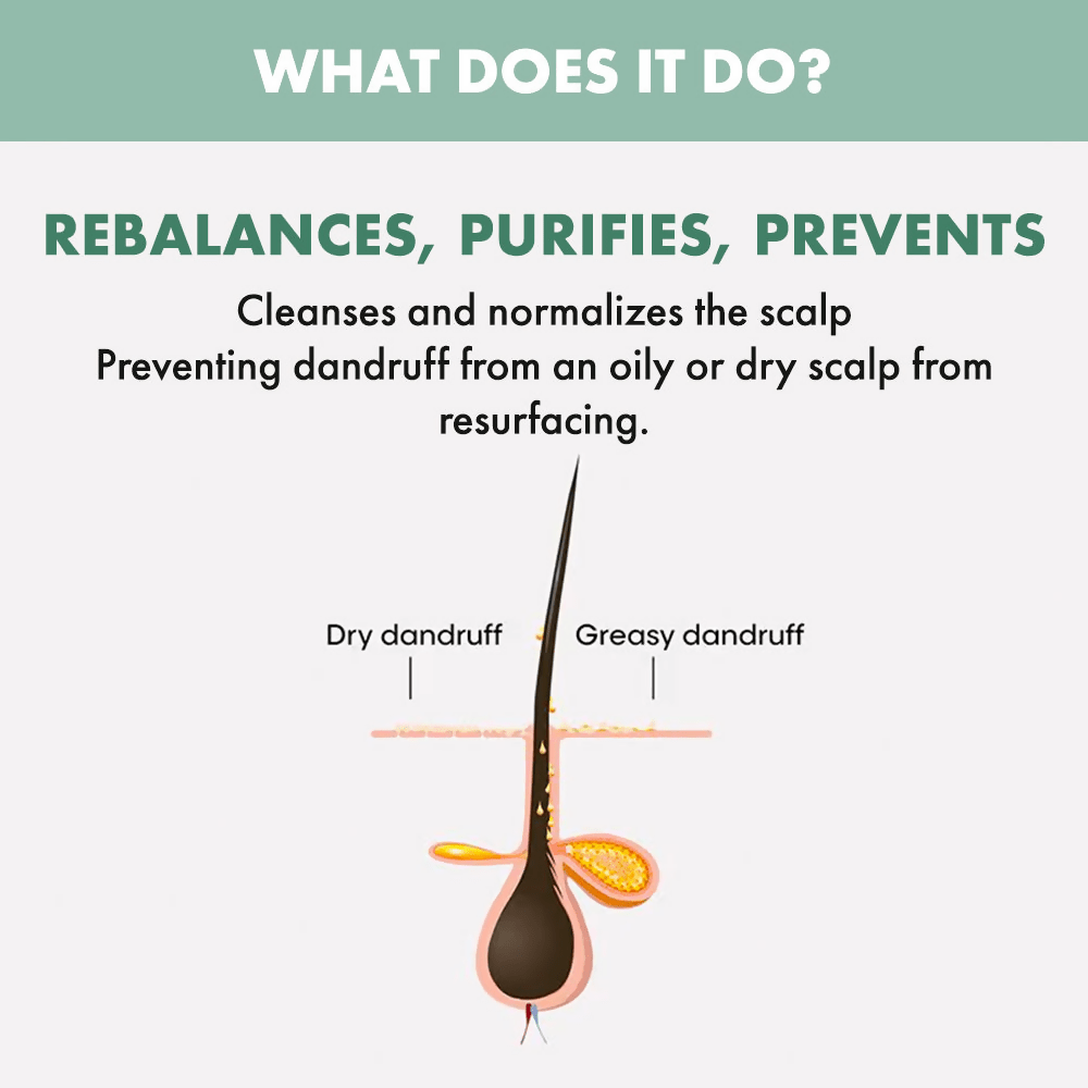 Alfaparf Milano Scalp Rebalance Purifying Shampoo Reduces Dandruff | Grocsy