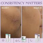 SkinInspired Retinol Face Serum (2% vitAlease) | Grocsy