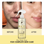 Aromatique Rice Water Toner for Face | Grocsy