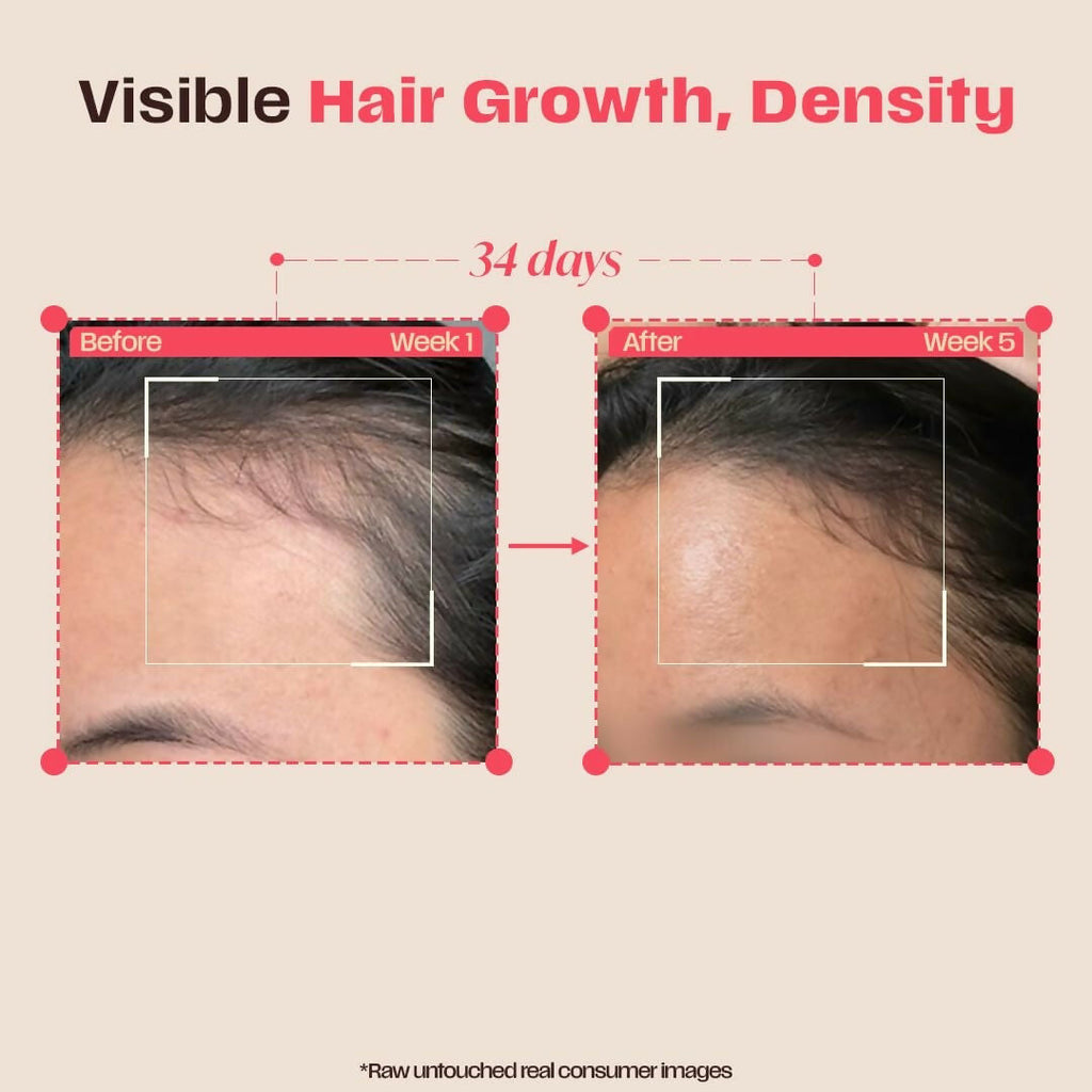Days Ahead Leave-in Hair Growth Ampoule Serum (Roll on) | Grocsy