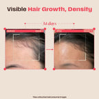 Days Ahead Leave-in Hair Growth Ampoule Serum (Roll on) | Grocsy