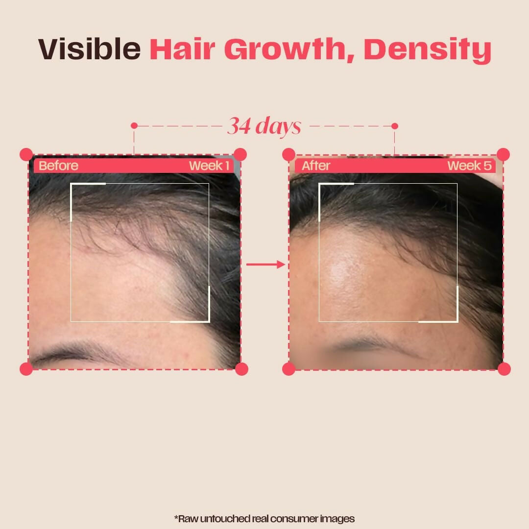Days Ahead Leave-in Hair Growth Ampoule Serum (Roll on) | Grocsy