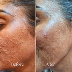 BiE Superpower Eternal Youth Cream With Collagen Boosters For Brightening & Anti-Aging | Grocsy