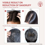 Ivory Natural Dandruff Hair Serum For Nourishing Dry Scalp | Grocsy