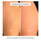 Cos-IQ Stretch Marks Removal Roll-On Serum with Striover | Grocsy