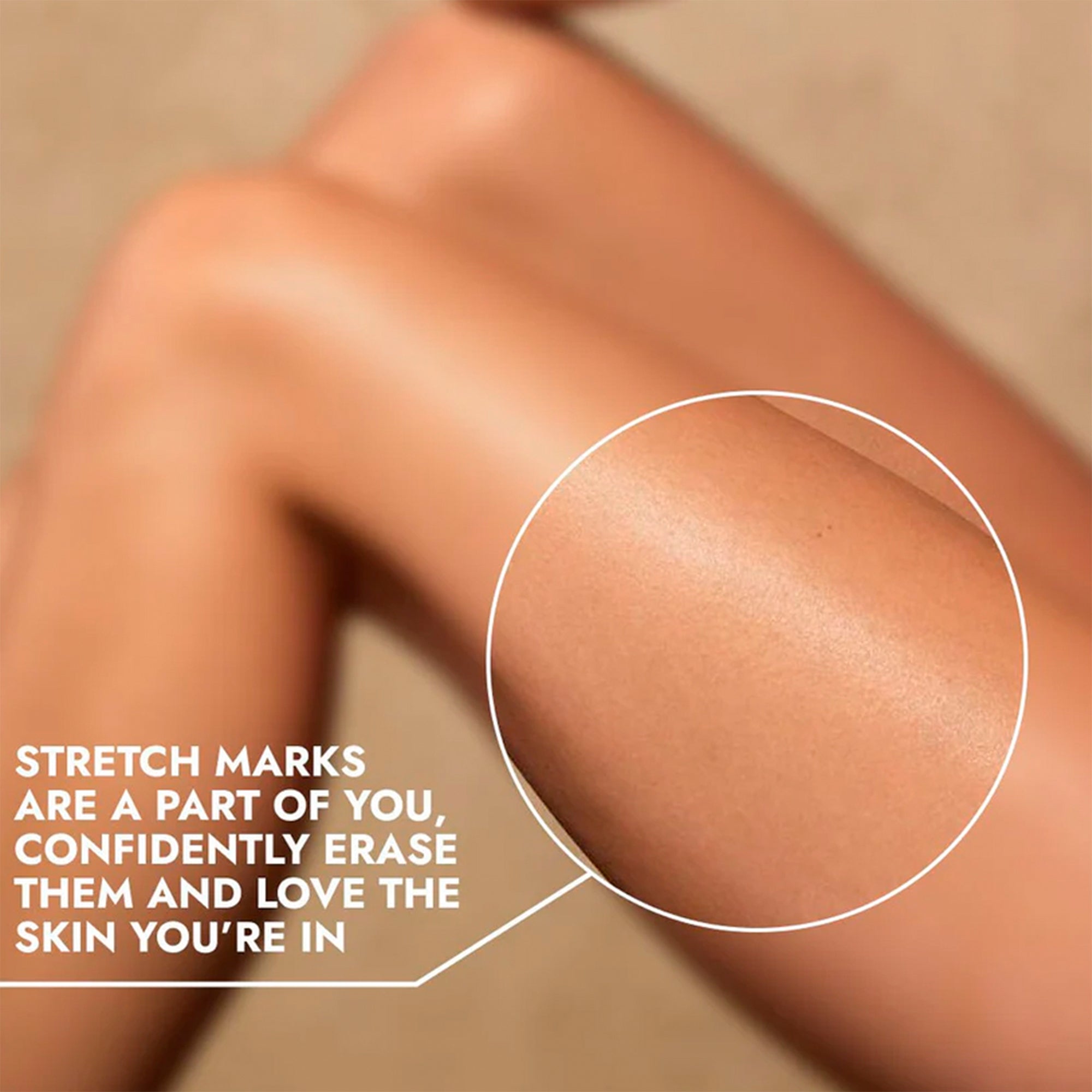 Cos-IQ Stretch Marks Removal Roll-On Serum with Striover | Grocsy