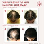 Ivory Natural Hair Fall Hair Mask - Loss Of Hair Control For Both Men & Women | Grocsy