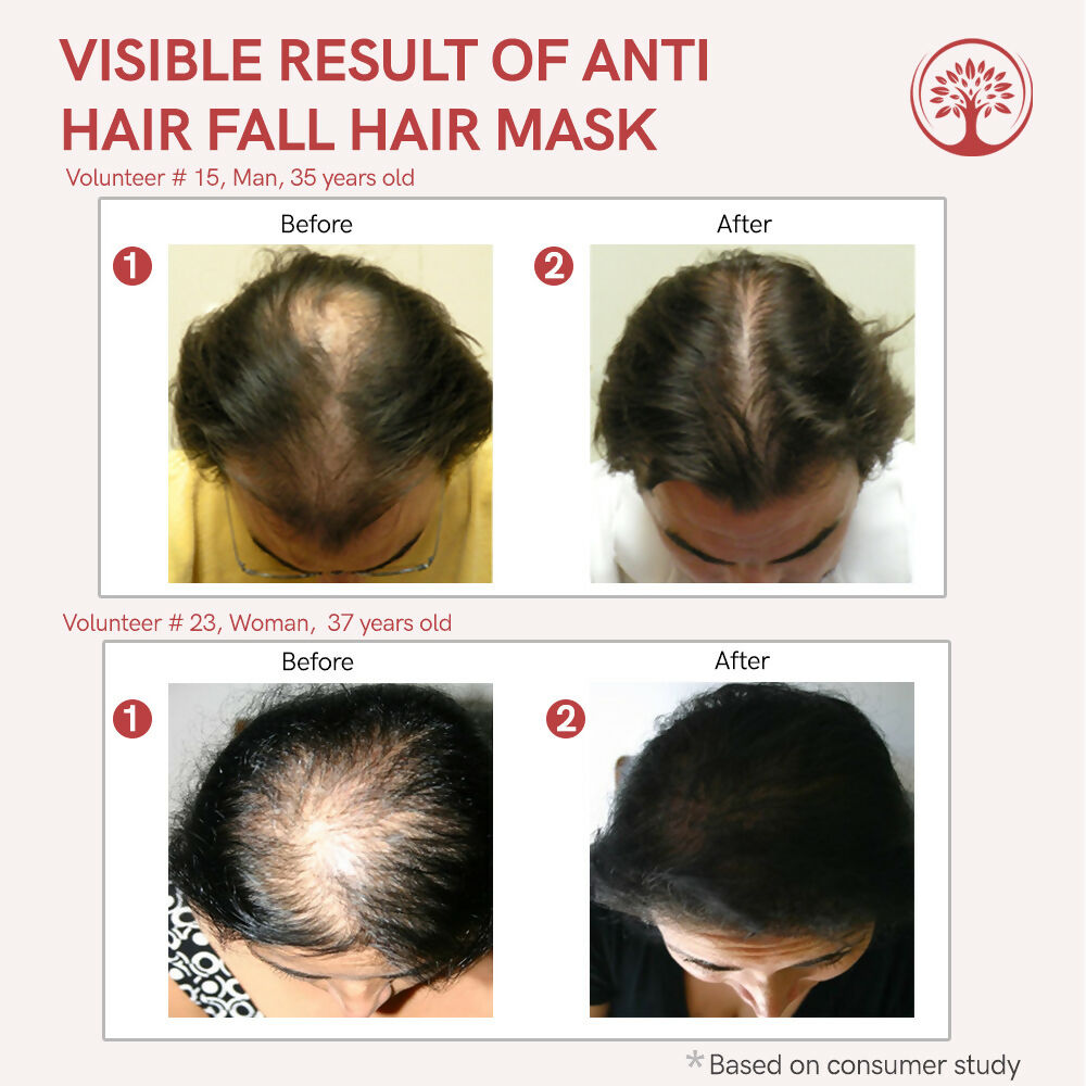 Ivory Natural Hair Fall Hair Mask - Loss Of Hair Control For Both Men & Women | Grocsy
