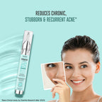 Dermafique Acne Avert Spot Corrector Face Serum | Grocsy