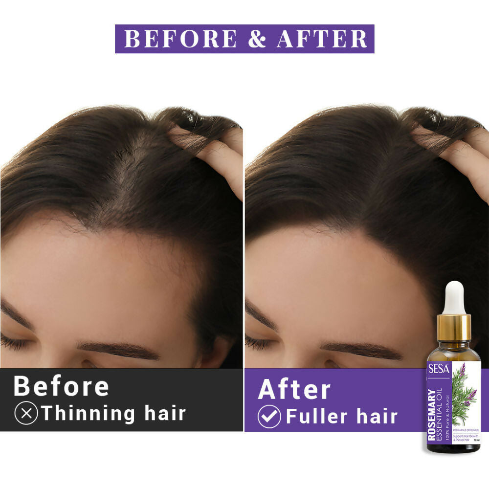 Sesa Ayurvedic Rosemary Essential Oil For Hair Growth | Grocsy