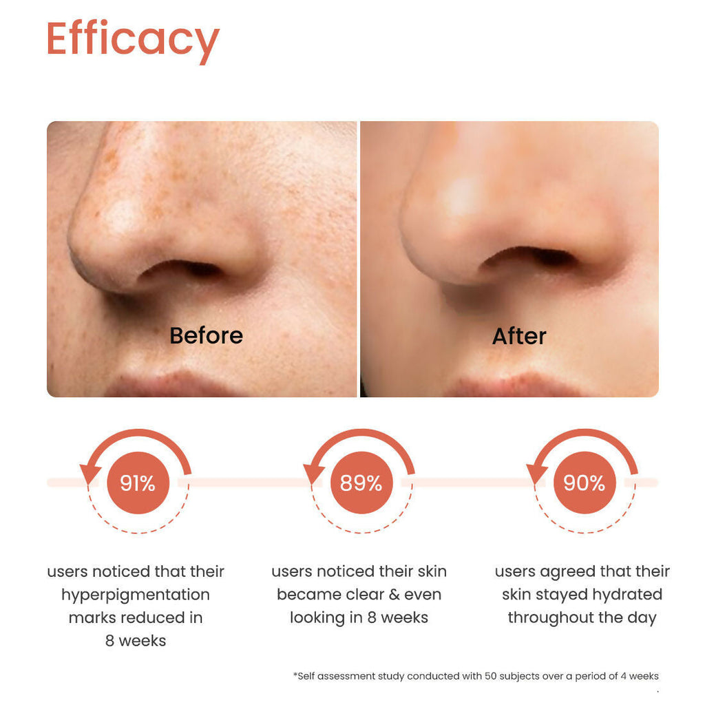 Earth Rhythm 2% Alpha Arbutin Depigmenting Face Serum | Grocsy