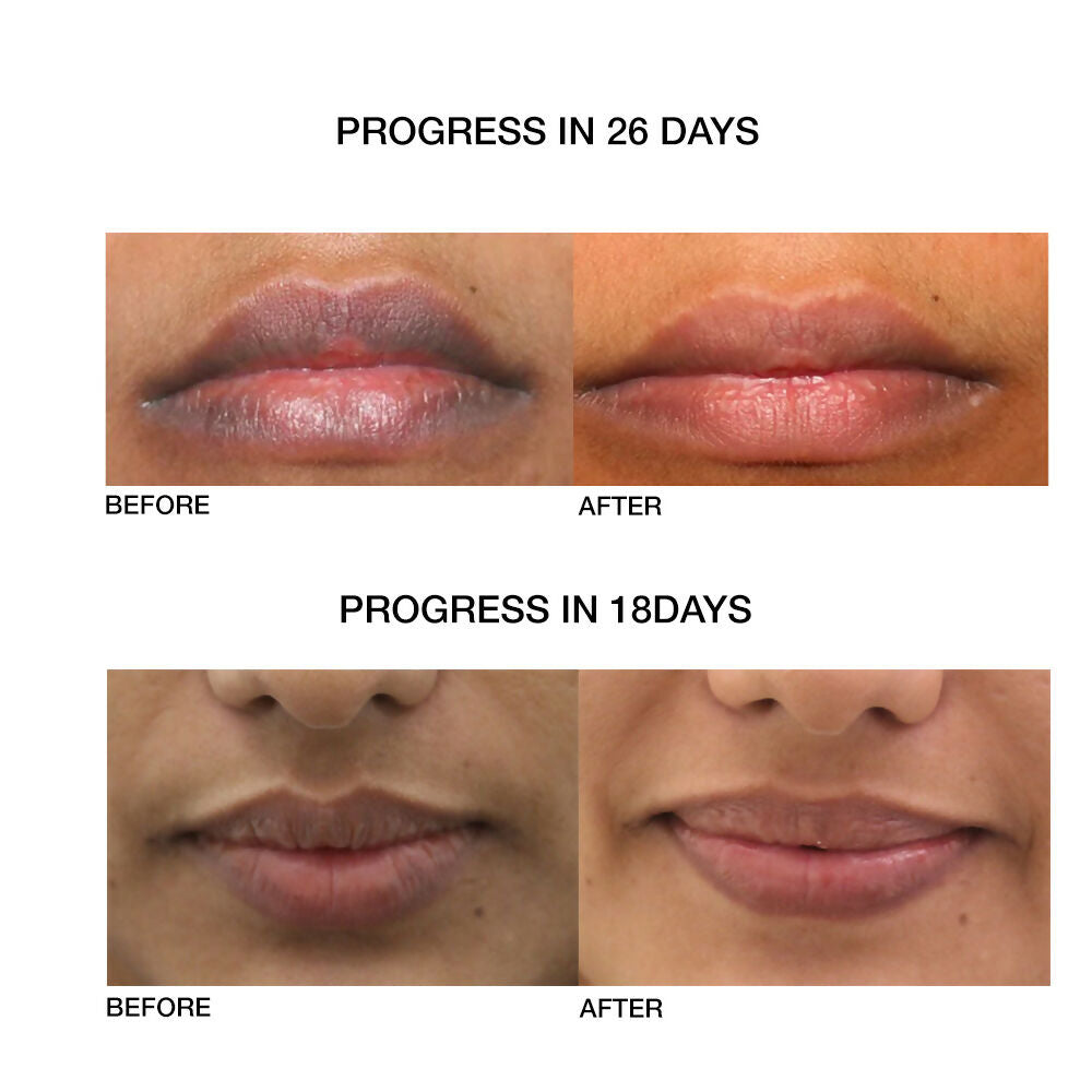 Skog Lip Repair Oil | Grocsy