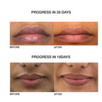 Skog Lip Repair Oil | Grocsy