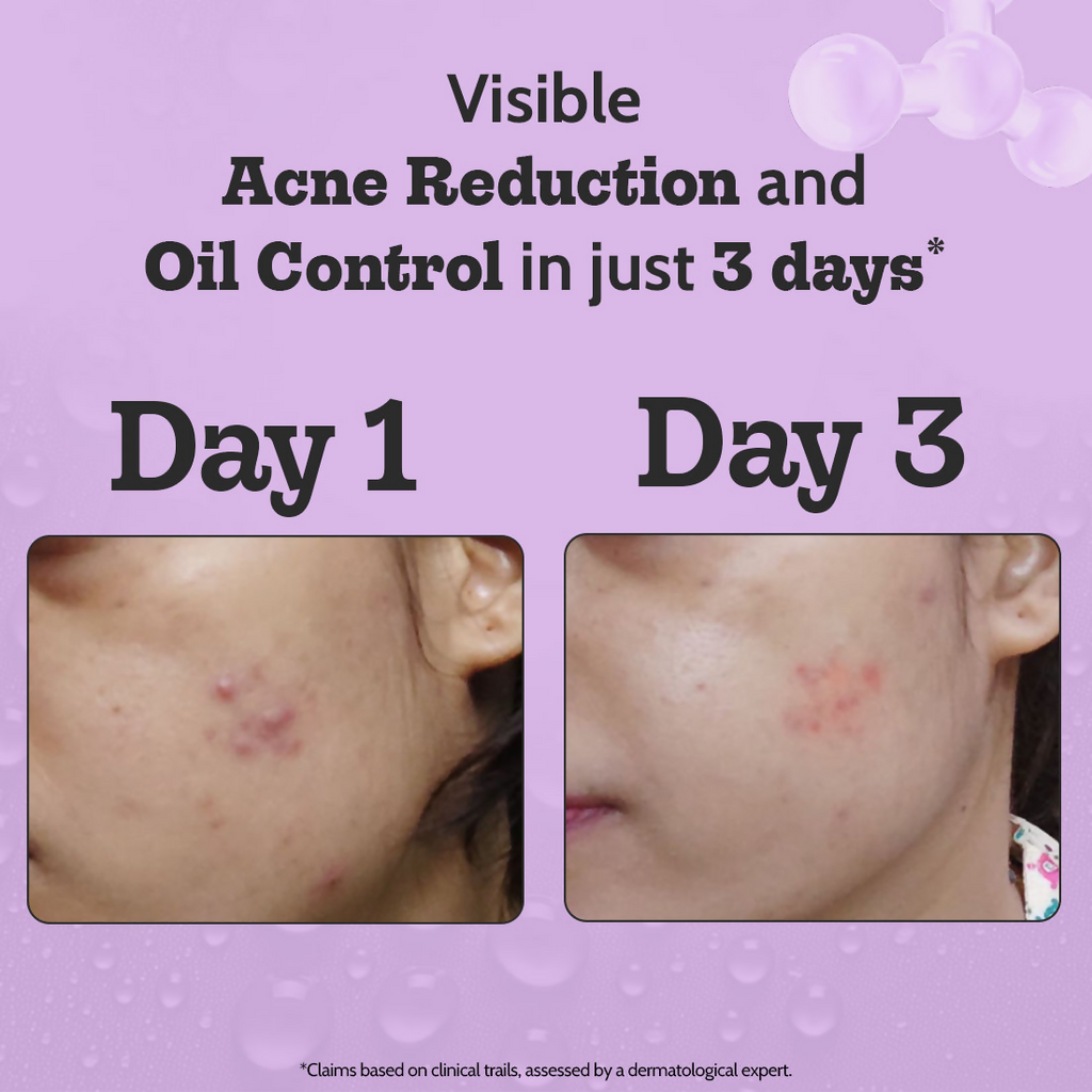 Chemist At Play 2% Salicylic Acid Face Serum | Grocsy