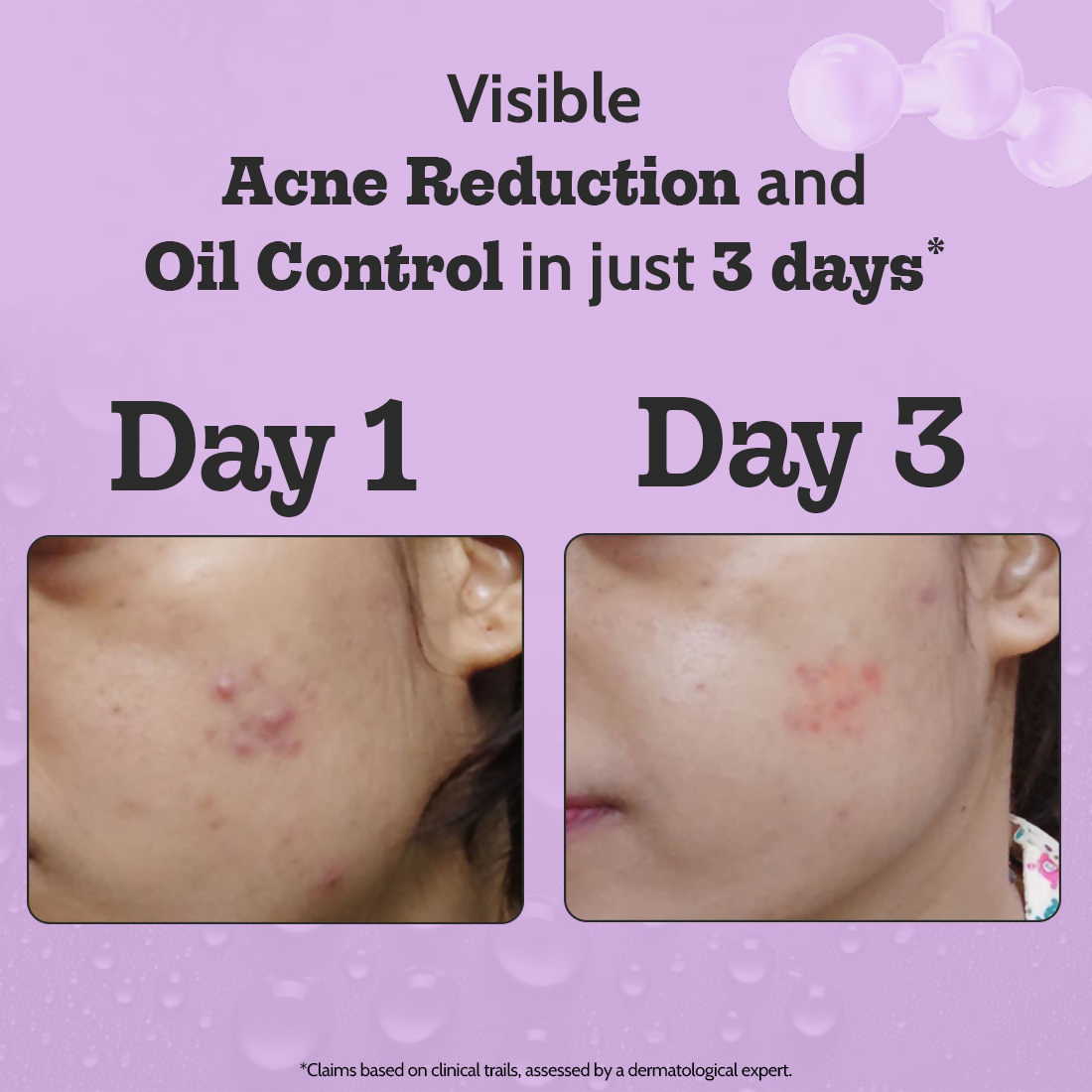 Chemist At Play 2% Salicylic Acid Face Serum | Grocsy
