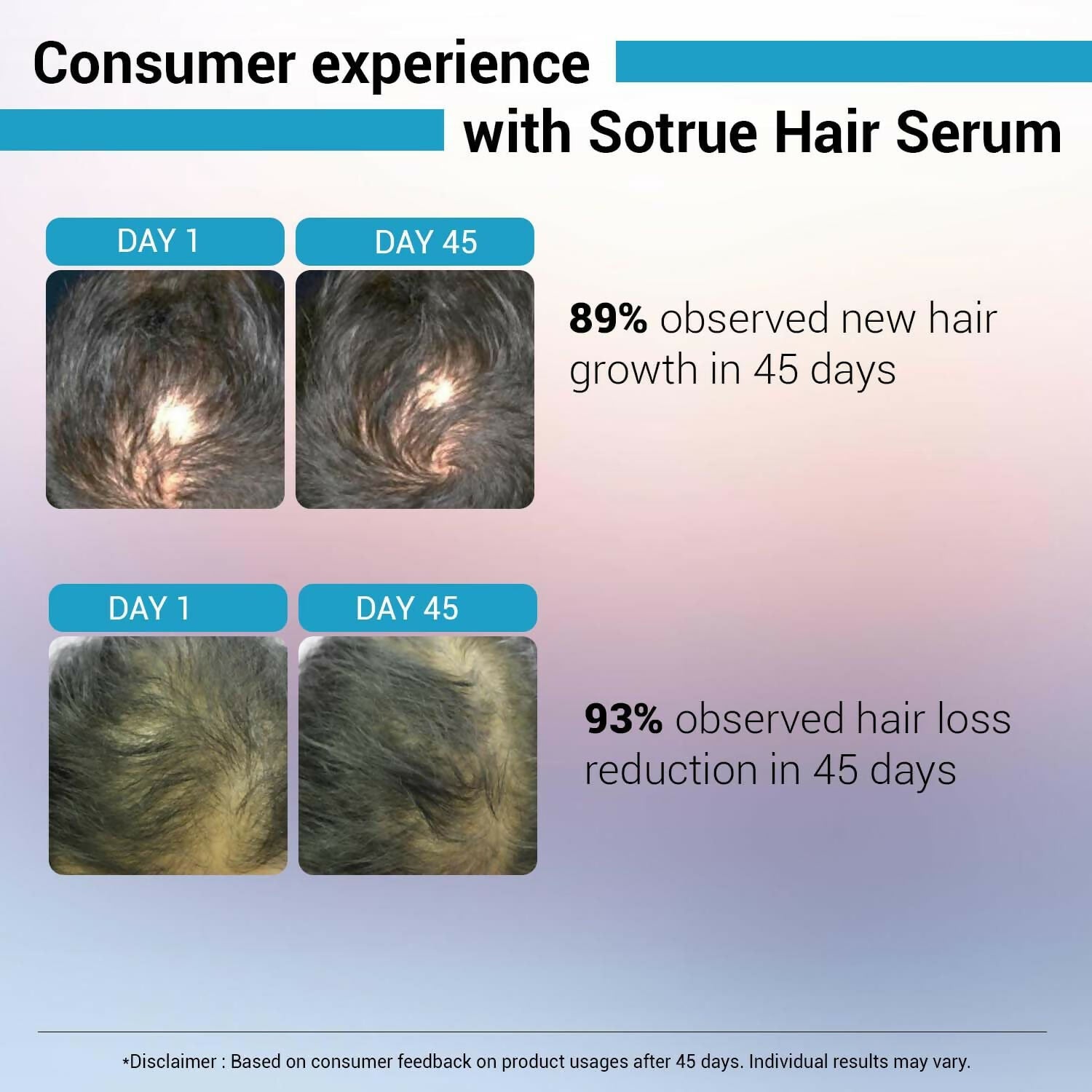Sotrue Hair Growth Serum With Redensyl 3%, Procapil 3%, Anagain 4% and Baicapil 2% Hair Growth Actives | Grocsy