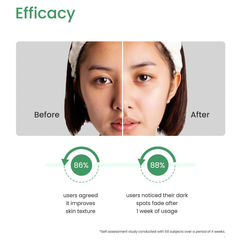 Earth Rhythm 10% Azelaic Acid Acne Control Face Serum | Grocsy