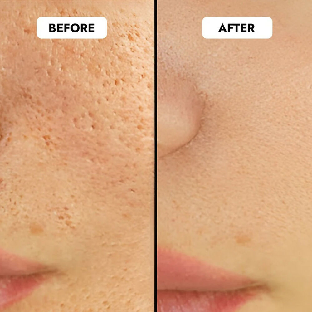 Cos-IQ Niacinamide Vitamin B3-5% Face Serum for Ultra Sensitive Skin | Grocsy