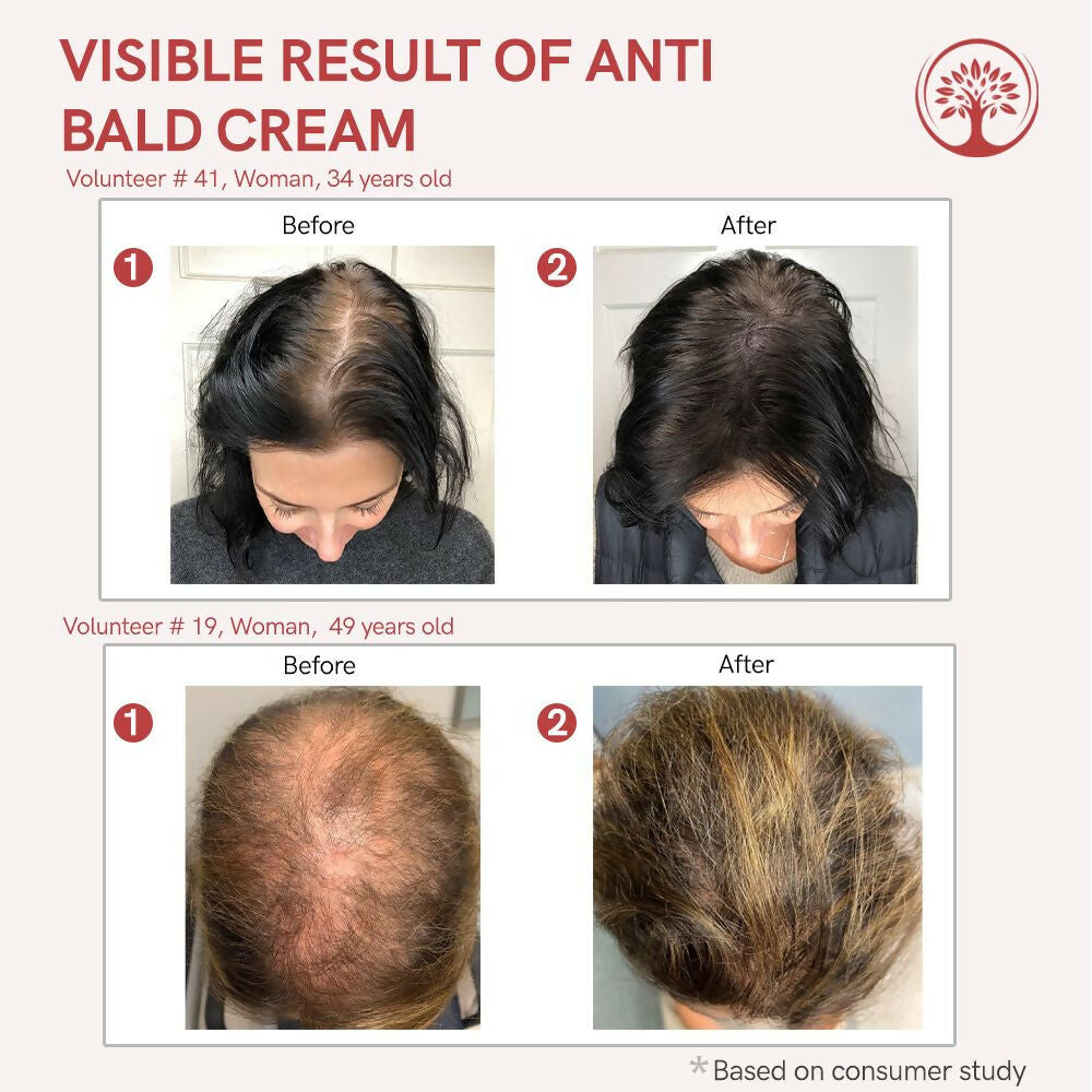 Ivory Natural Grey Combo For Hair - Natural Solution For Greys, Restore Natural Black And Shine Of Hair | Grocsy