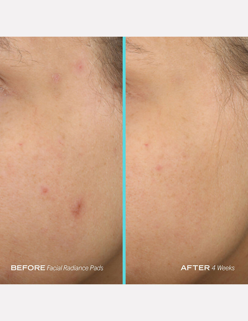 First Aid Beauty Facial Radiance Pads | Grocsy