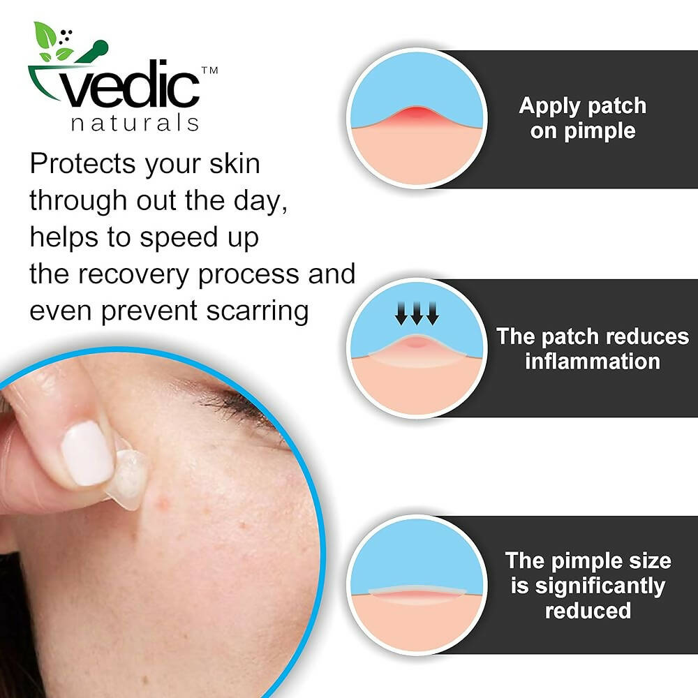 Vedic Naturals Acne Pimple Patches For Face & Skin Treatment | Grocsy