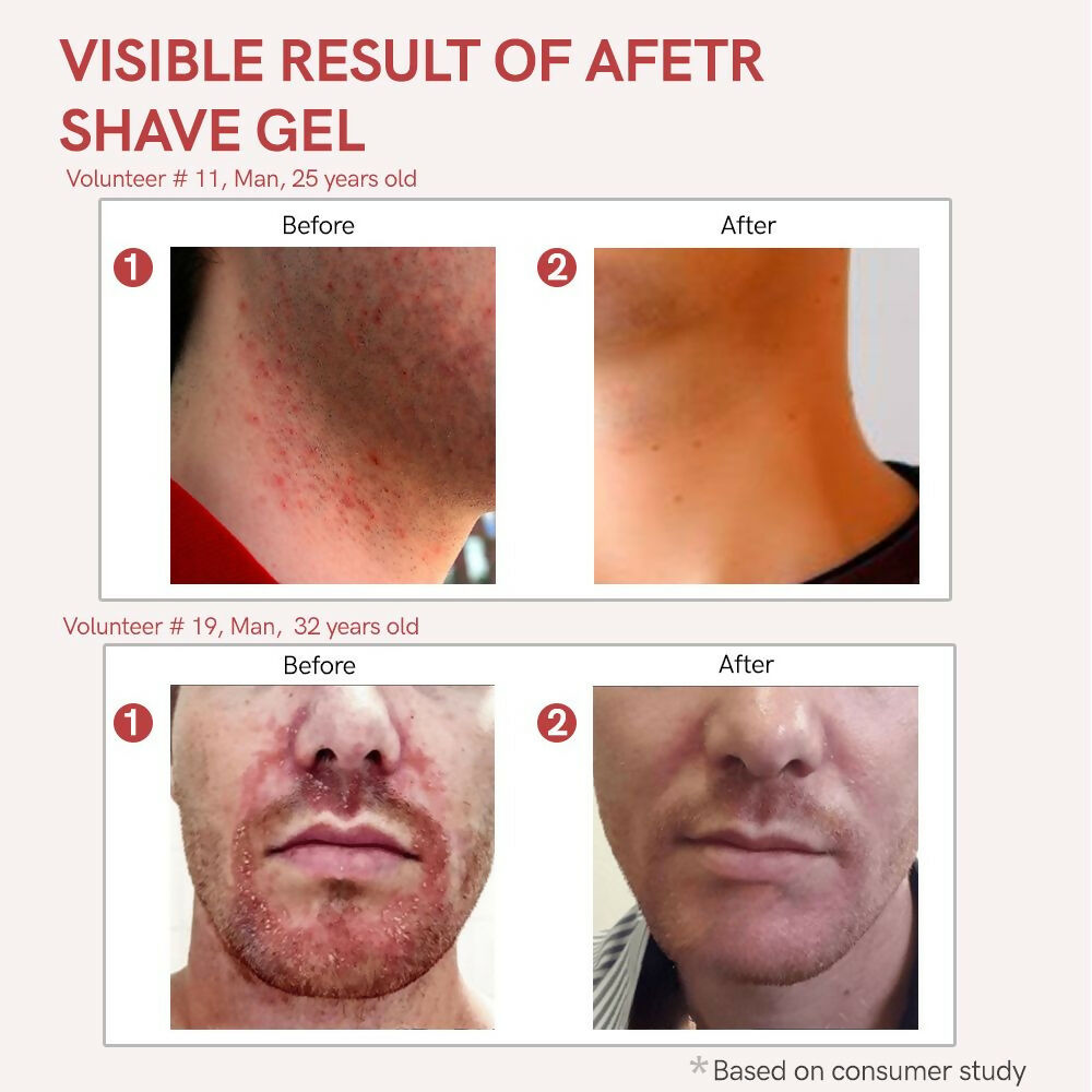 Ivory Natural After Shave Gel For Gentle Post-Shave, Reduced Facial Worries | Grocsy