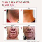 Ivory Natural After Shave Gel For Gentle Post-Shave, Reduced Facial Worries | Grocsy