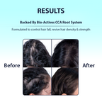 Dermistry Caffeine Collagen Protein Anti-Hair Fall Control Mask & Serum | Grocsy