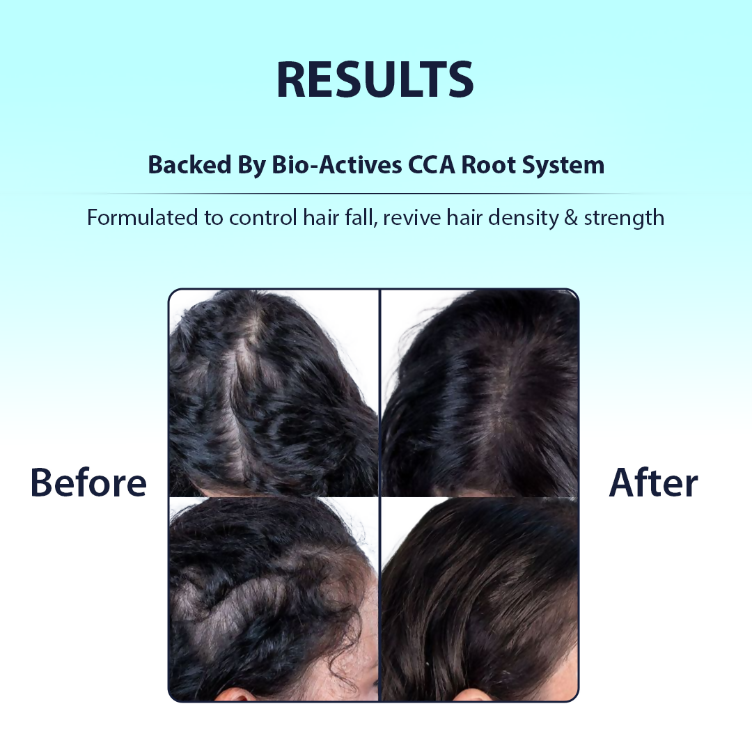 Dermistry Caffeine Collagen Protein Anti-Hair Fall Control Mask & Serum | Grocsy