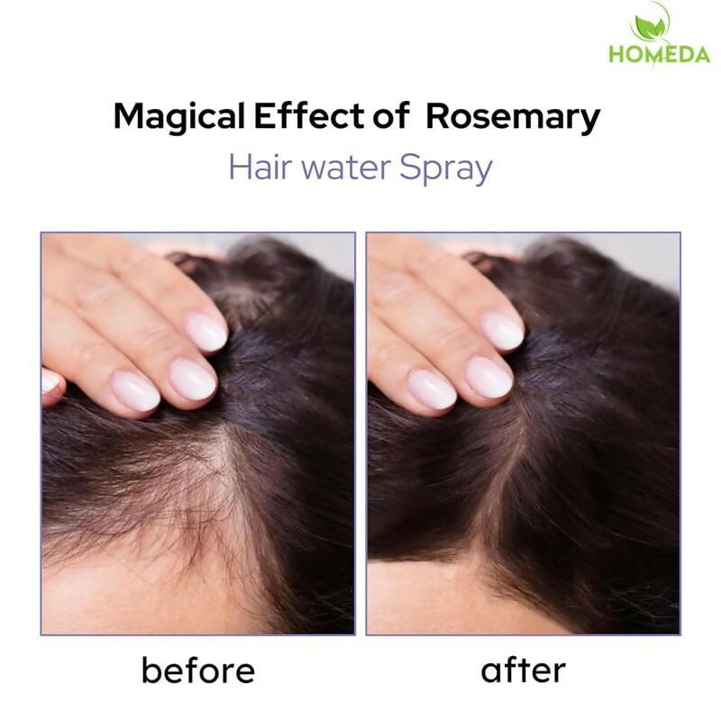 Homeda Rosemary Water For Hair Growth | Grocsy
