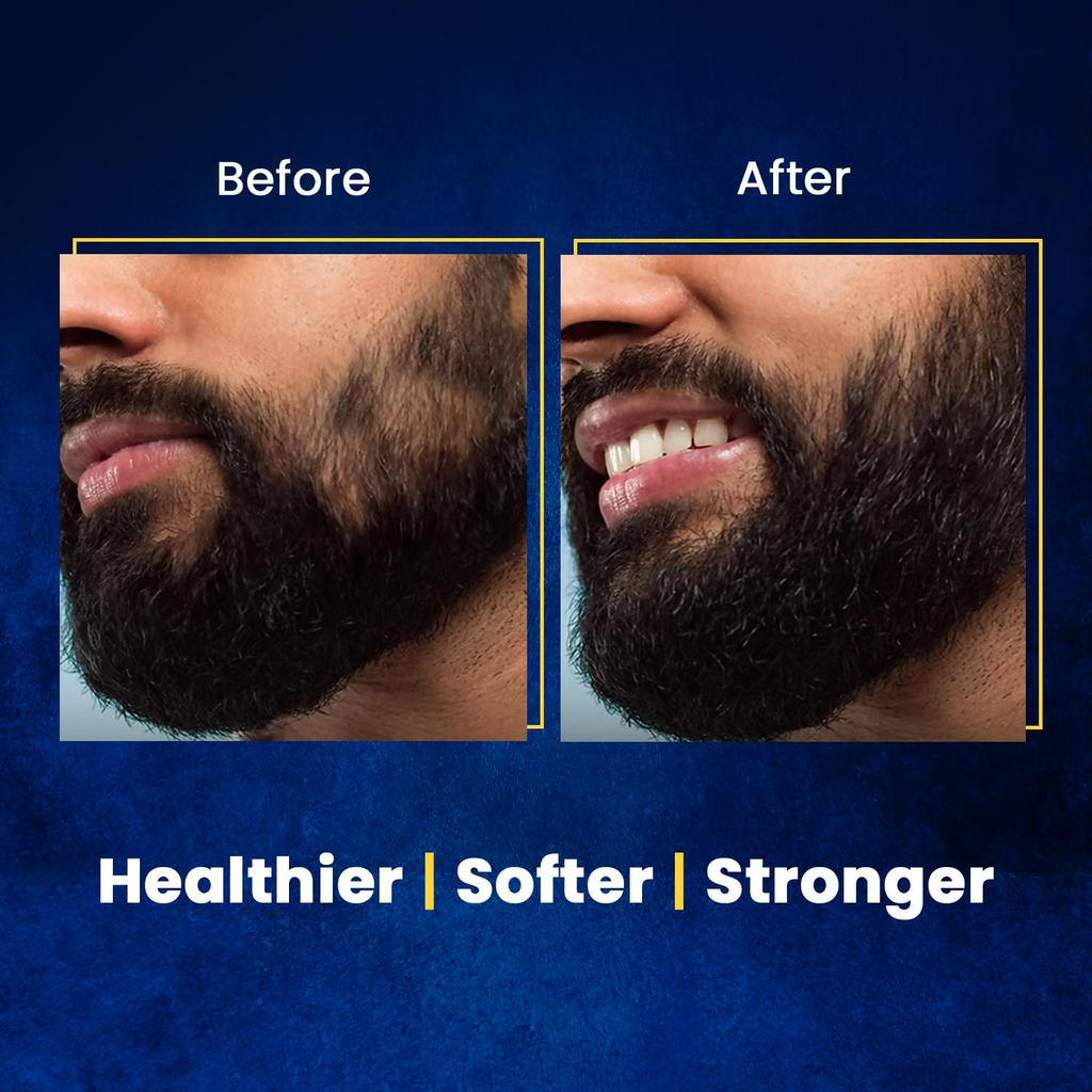 The Beard Story Beard Oil For Men | Grocsy