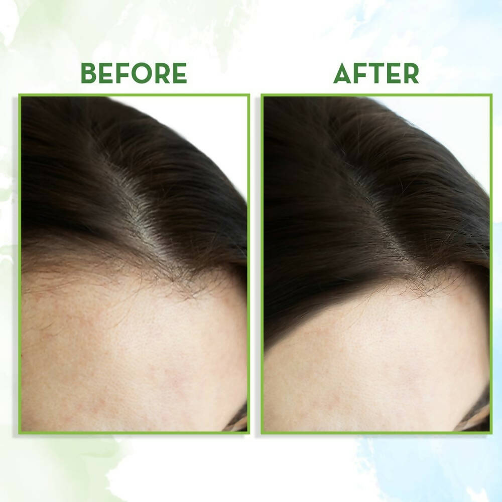 Mamaearth Rosemary Hair Growth Oil with Rosemary & Methi Dana | Grocsy