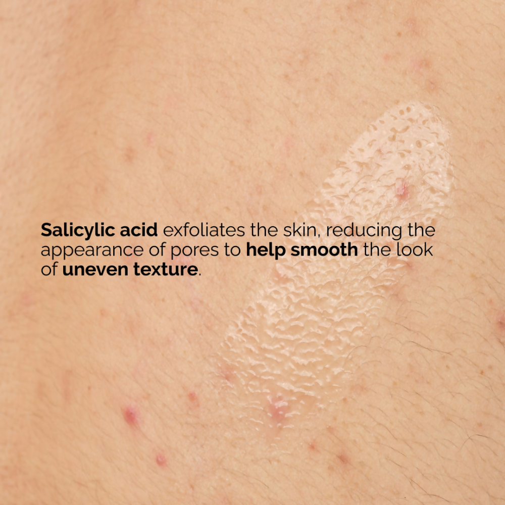 The Ordinary Salicylic Acid 0.5% Body Serum | Grocsy